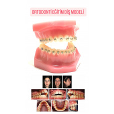 ORTODONTİ EĞİTİM DİŞ MODELİ