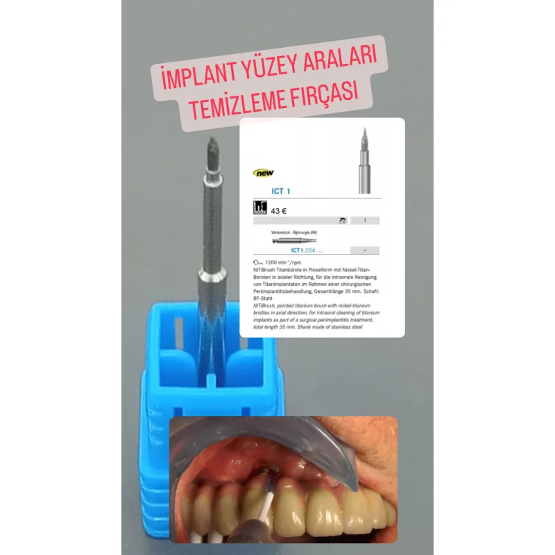 İmplant Yüzey Aralari Temizleme Firçasi -ict1-