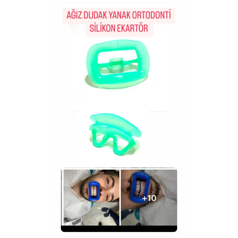 Ağiz Dudak Yanak Ortodonti Silikon Ekartör