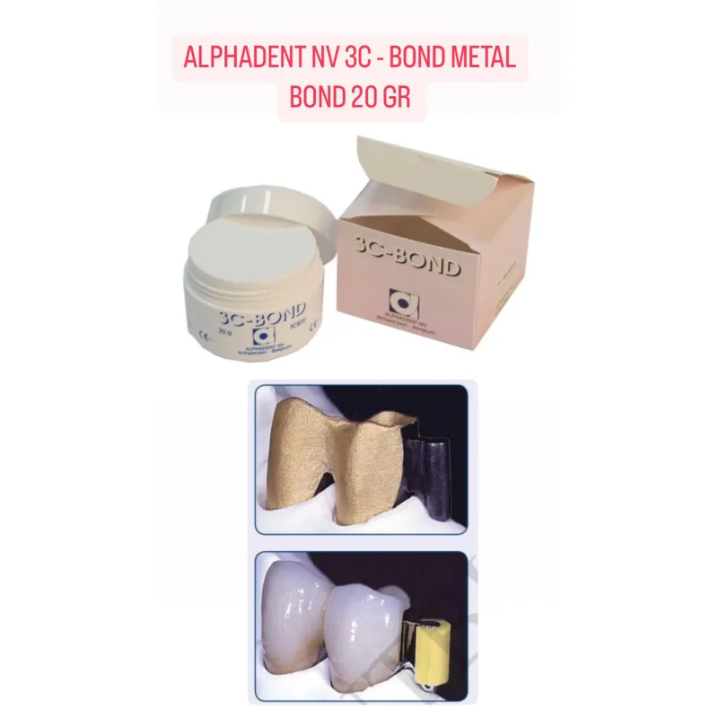 Alphadent Nv 3c-metal Bond 20 Gr