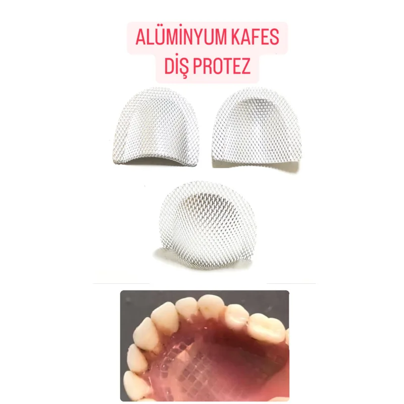 Alüminyum Kafes Laboratuvar Diş Protez