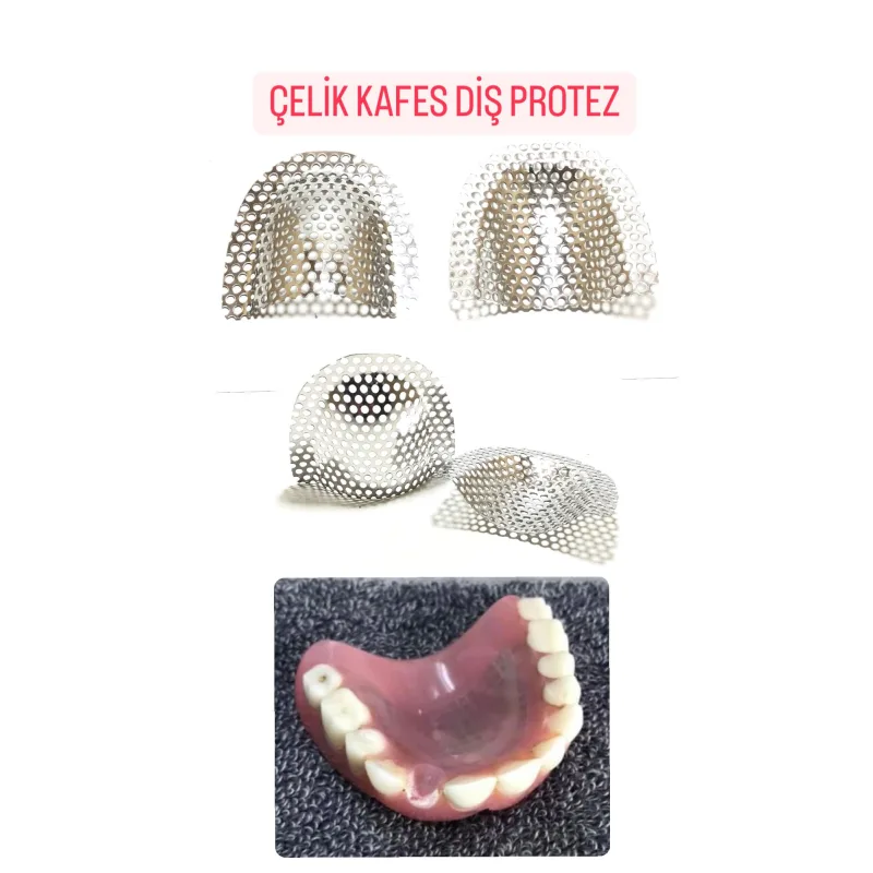 Çelik Kafes Diş Protez