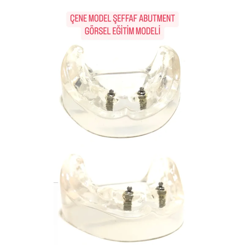 Çene Model Şeffaf Abutment Görsel Eğitim Modeli