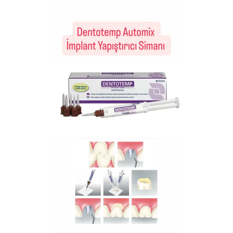 Dentotemp Automix İmplant Yapiştirici Simani 1 Şiringa 5 Ml Paket