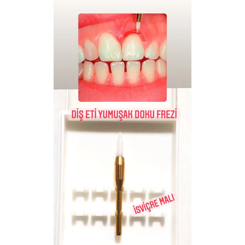 Dia Tessin Diş Eti Yumuşak Doku Seramik Frezi