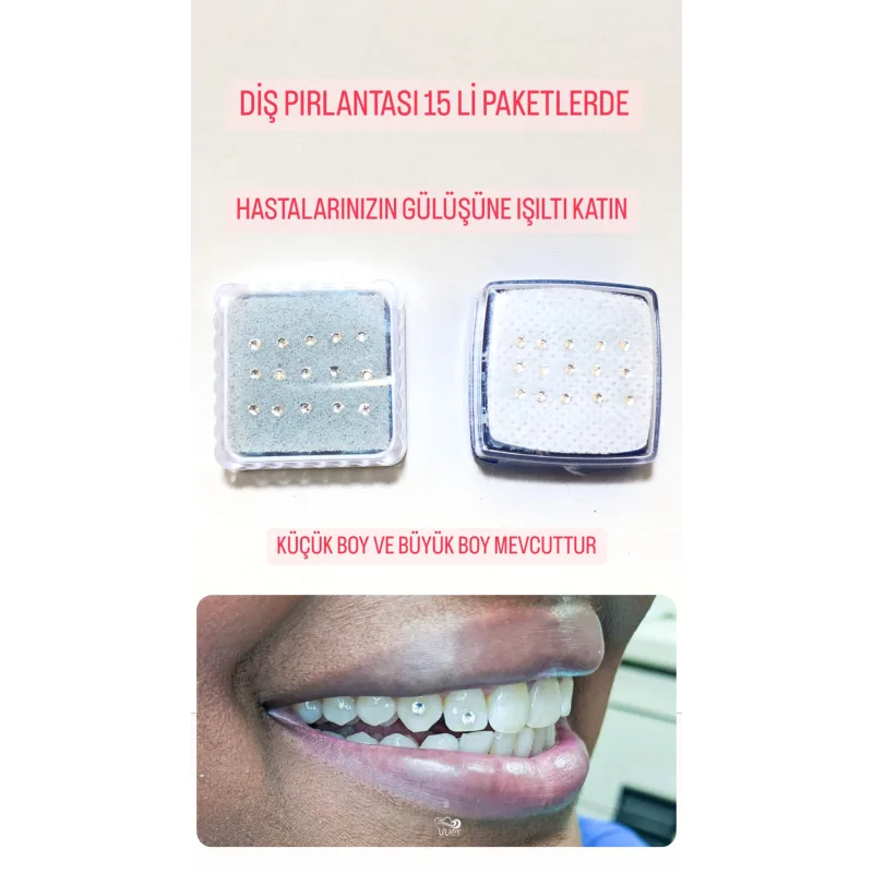 Diş Pirlantasi 15'li Paketlerde -küçük Boy Büyük Boy Mevcuttur -