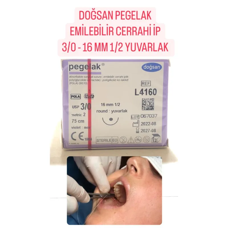 Doğsan Pegelak Emilebilir Cerrahi İp 3/0-16mm 1/2 Yuvarlak