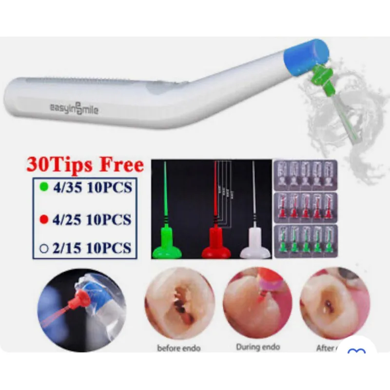 Endo Sonic Aktivatör İrigasyon Ucu 10'lu Paket -medium (25/04) 2mm