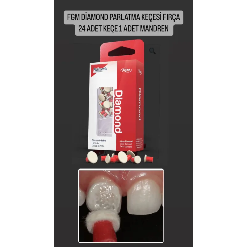 Fgm Diamond Parlatma Keçesi Firça 24 Adet Keçe 1 Adet Mandren