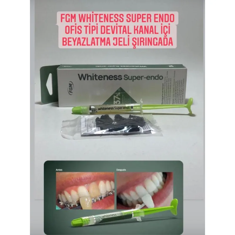 Fgm Whiteness Super Endo Ofis Tipi Devital Kanal İçi Beyazlatma Jeli Şiringa