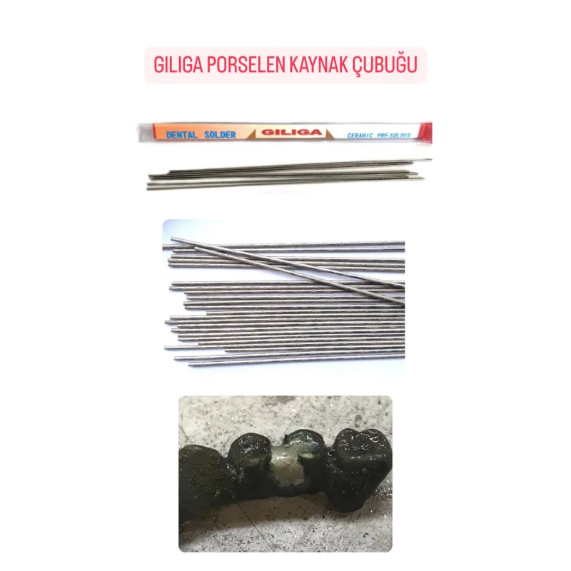 Giliga Porselen Diş Dental Kaynak Çubuğu
