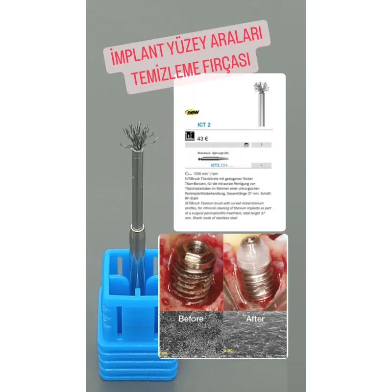 İmplant Yüzey Aralari Temizleme Firçasi -ict2-