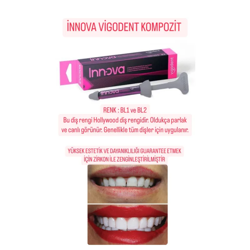 İnnova Vigodent Kompozit Hollywood Smile Bl1-bl2