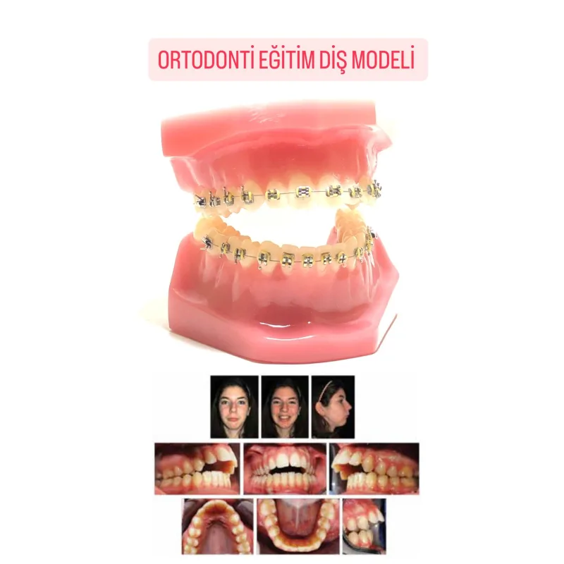 Ortodonti Eğitim Diş Modeli