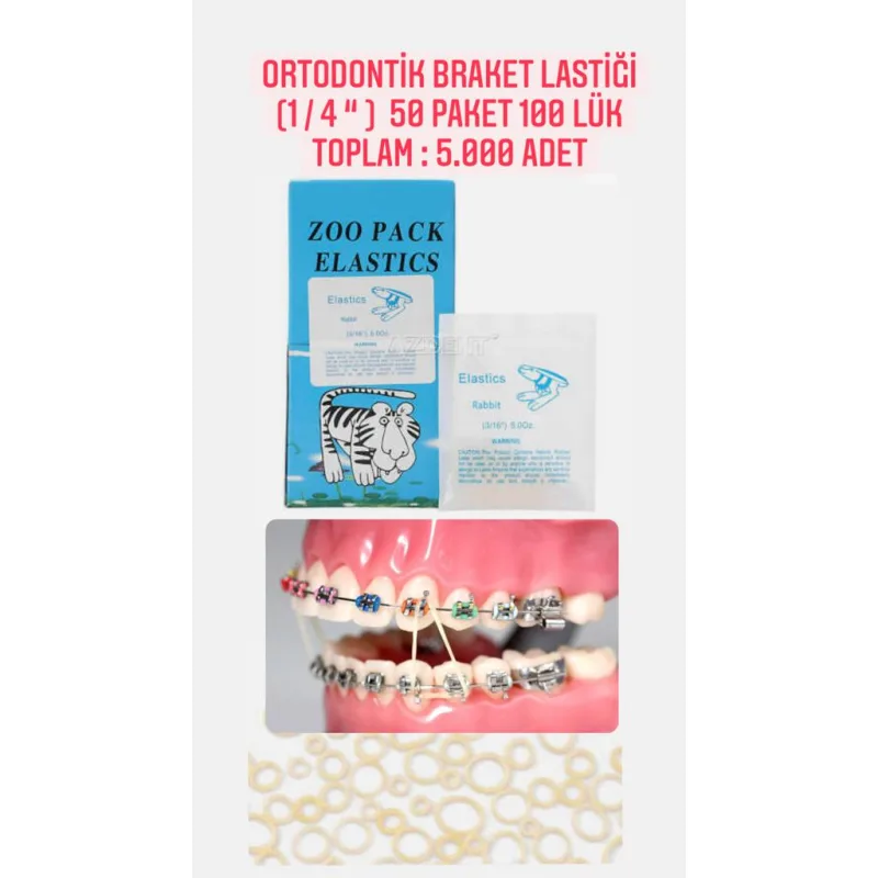 Ortodontik Braket Lastiği (1/4) 50 Paket 100'lük