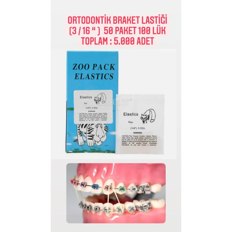 Ortodontik Braket Lastiği (3/16) 50 Paket 100'lük
