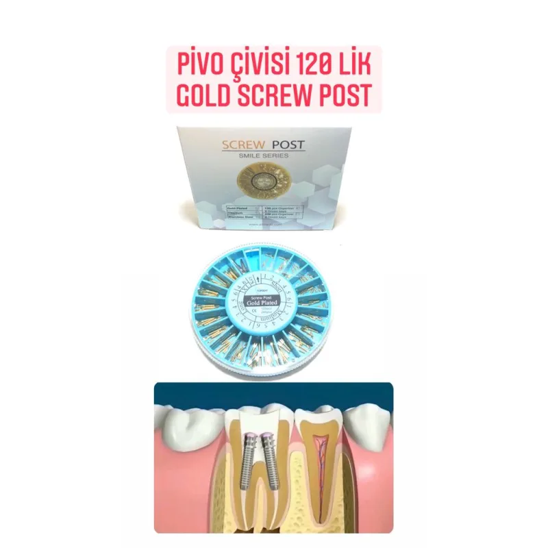 Pivo Çivisi 120 Lik Gold Screw Post