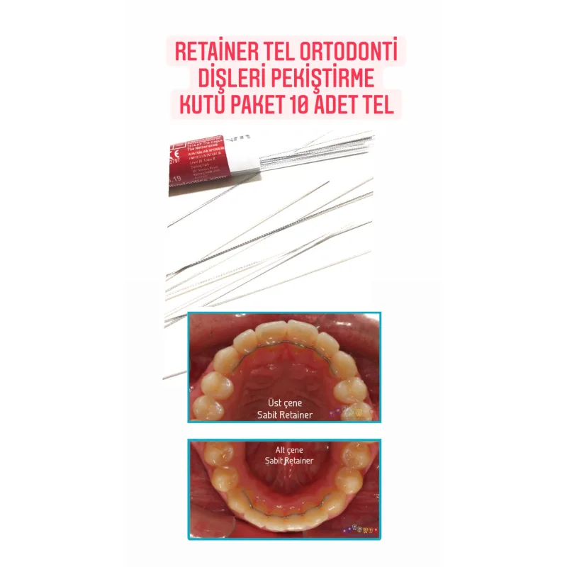 Retainer Tel Ortodonti Dişleri Pekiştirme Kutu Paket 10 Adet Tel