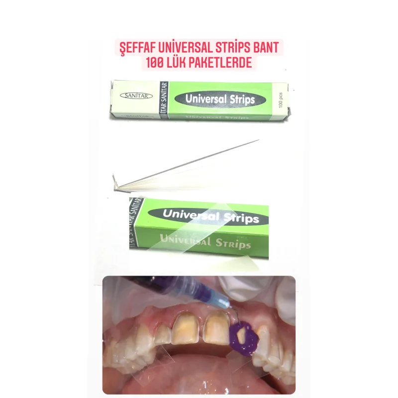 Şeffaf Universal Strips Bant 100'lük Paketlerde