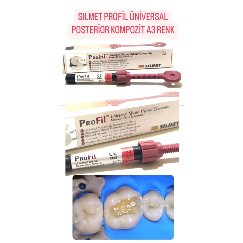 Silmet Profil Üniversal Posterior Kompozit A3 Renk
