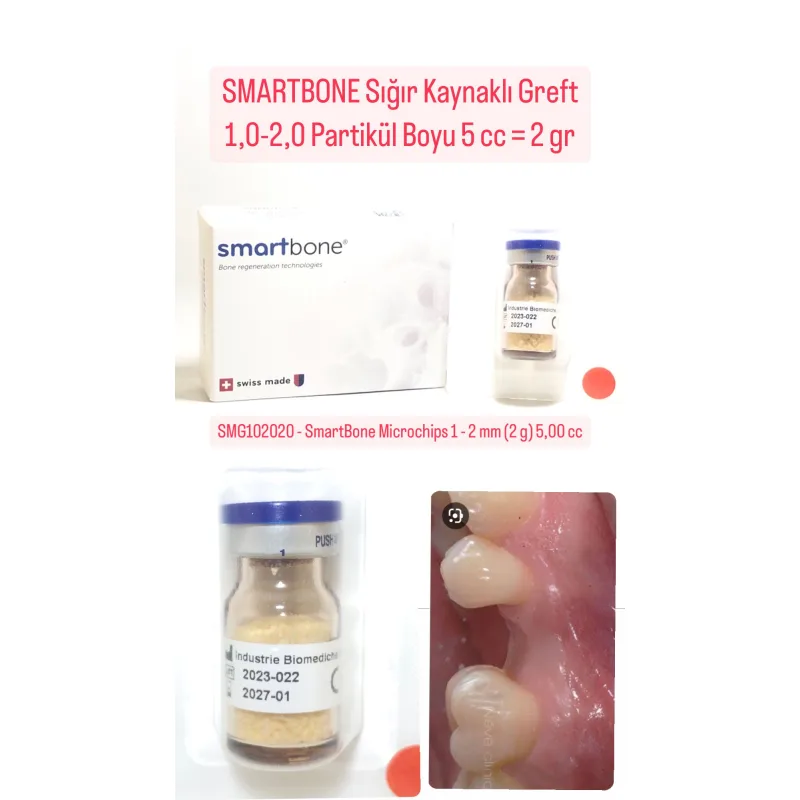 Smartbone Siğir Kaynakli Greft 1,0-2,0 Partikül Boyu 5cc=2gr
