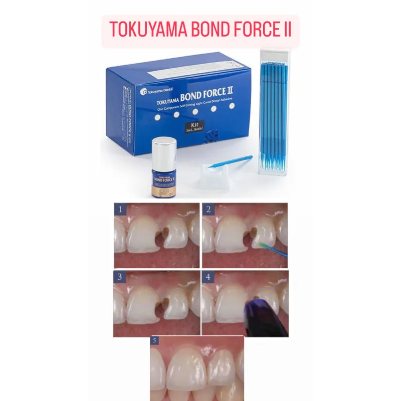 Tokuyama Bond Force İi