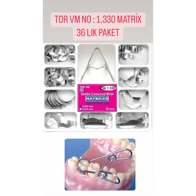 Tor Vm No: 1.330 Matrix 36'lik Paket