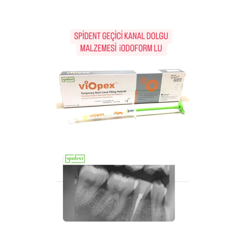 Viopex Spident Geçici Kanal Dolgu Malzemesi İodoformlu