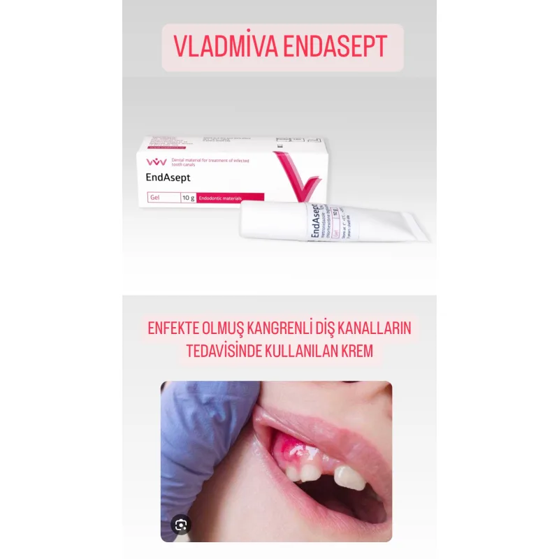 Vladmiva Endasept Enfekte Olmuş Kangrenli Diş Kanallarin Tedavisinde Kullanilan Krem