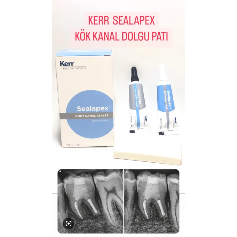 Kerr Sealapex Kök Kanal Dolgu Patı