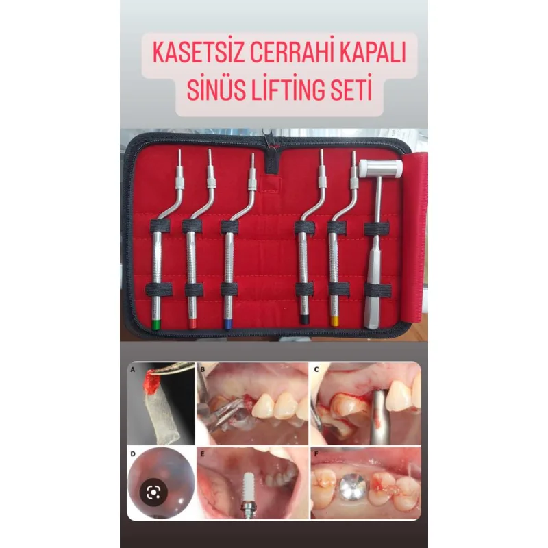 Kasetsiz Cerrahi Kapalı Sinüs Lifting Seti